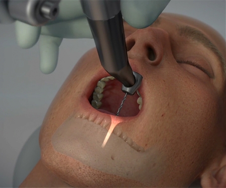 (Video) Yomi, The First Robotic Dental Surgery System Now Cleared by FDA