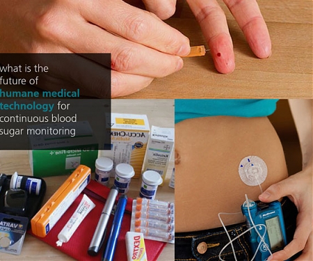 Glycount : Future Vision of Humane Diabetes Management Through Wearable Gadget