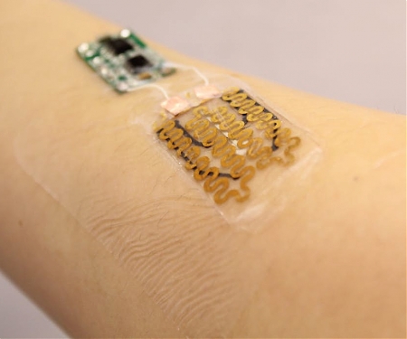 Smart Bandage Could Monitor and Medicate Chronic Wounds