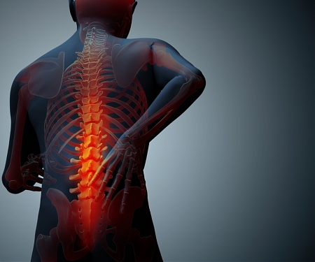 Oxford Performance Materials Gains FDA Approval for 3D Printed Spinal Implants