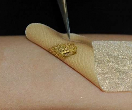 Wearable Sensors Mimic Skin to Help with Wound Healing Process