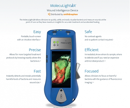 Handheld Device Reveals Bacteria in Wounds - The MolecuLight i:X