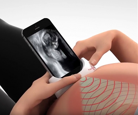 (Video) PulseNmore At-Home Tele-Ultrasound for Pregnant Women