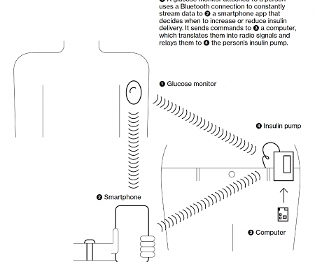 The $250 Biohack That’s Revolutionizing Life With Diabetes