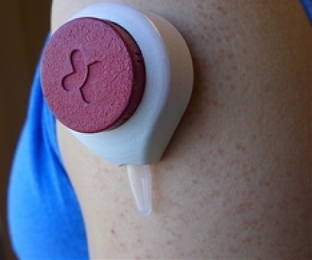 Simple Sample : Federal Grant Advances Pain-Free Blood Tests