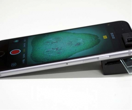 Add-On Clip Turns Smartphone Into Fully Operational Microscope