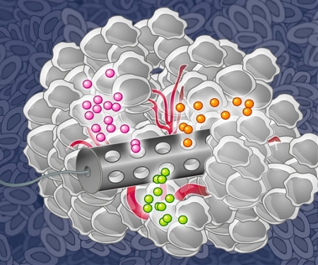 MIT - Implantable Device Could Allow for Better-Targeted Cancer Treatment