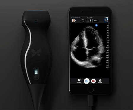 (Video) Pocket-sized, Affordably-Priced Ultrasound Connects to an iPhone - Butterfly iQ