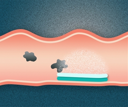MIT - Engineers Develop a Pill for Long-Term Drug Release