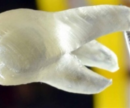 3D-Printed Teeth Can Kill 99% of Bacteria
