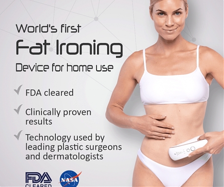 Fat Iron : Iron Off Stubborn Fat & Stretch Marks