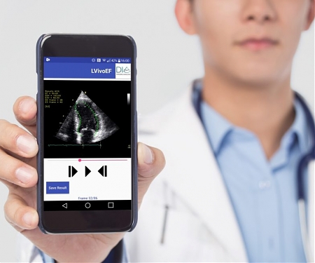 Israel-based Dia Imaging Analysis Raises $5M for AI That Analyzes Ultrasound Scans