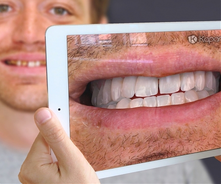 (Video) Augmented Reality for the Future of Dentistry - Kapanu