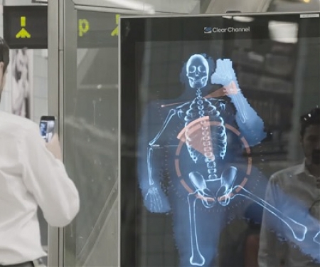 (Video) Surface Pro 4 Real Time Posture Scanner