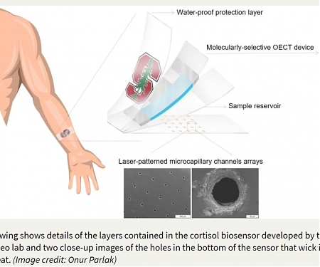 (PDF) Breakthrough Stanford Wearable Detects Stress Levels Through Sweat