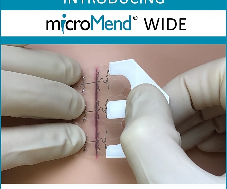 At-Home No-Stitch Wound Healing Kit Fundraises $3 Million