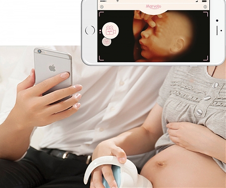 The Smart Baby Camera