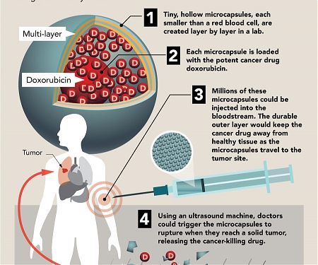 UAB Creates Triple-Threat Cancer-Fighting Polymer Capsules for Guided Drug Delivery