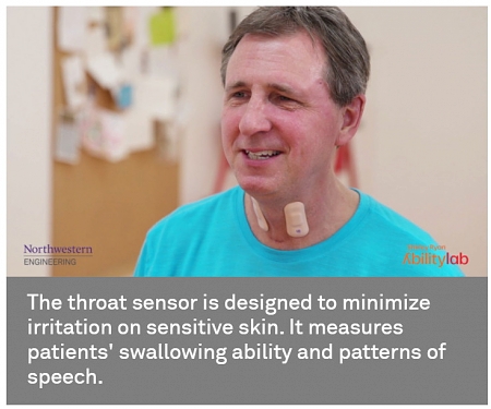 Stretchable Throat Sensor a "Game-Changer" in Stroke Treatment