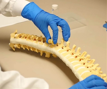 (Video) Spongy Polymer Grows to Fill Gaps in The Spine After Surgery