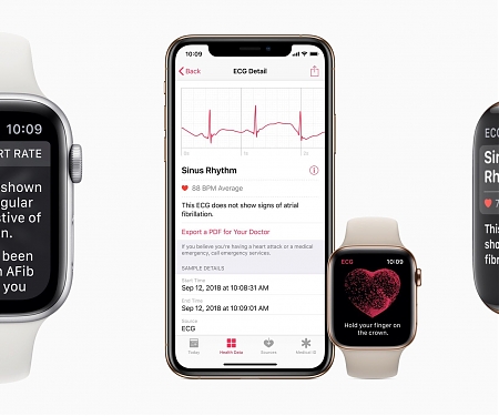 Mayo Clinic Sees Big Success with AI Detecting Weak Heart Pumps via ECGs