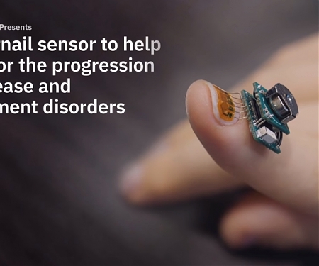 (PDF) IBM’s Tiny Fingernail Sensor Monitors Diseases & Movement Disorders