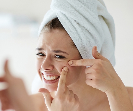 (PDF) World's First Acne Genetics Study Gives Hope for New Treatment