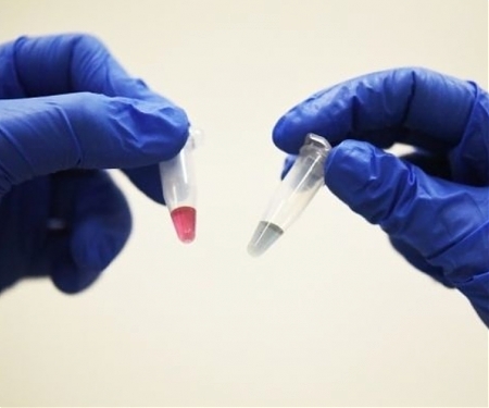 Scientists Create 10-Minute Test That can Detect Cancer Anywhere in the Body