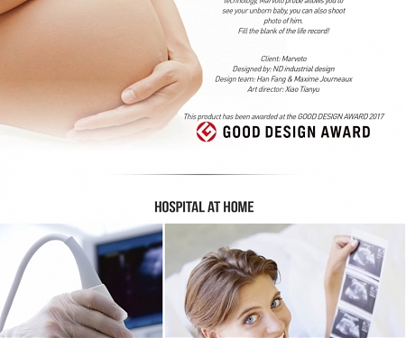 Smart Baby Camera - Ultrasound Probe