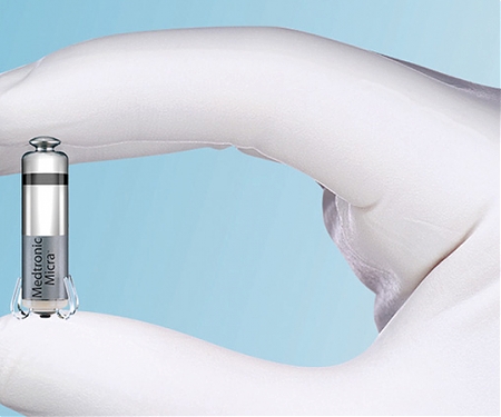 The World’s Smallest Pacemaker Can Be Implanted Without Surgery