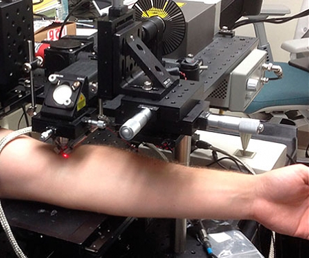 Laser Destroys Cancer Cells Circulating in the Blood