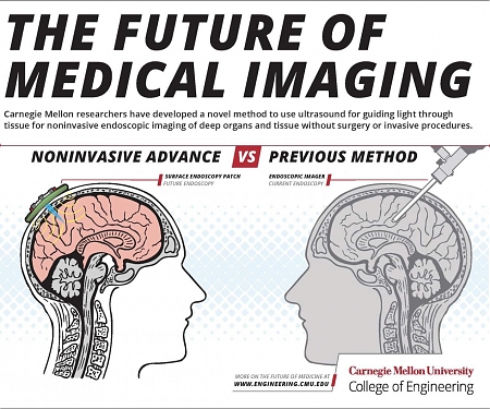 (PDF) The Future of Medical Imaging : Ultrasound-Assisted Optical Imaging System