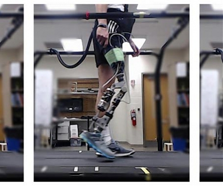 AI Helps Amputees Walk With a Robotic Knee