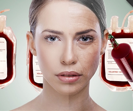 A Controversial Treatment Allows Older People to Fight the Effects of Aging with Young Blood - Ambrosia