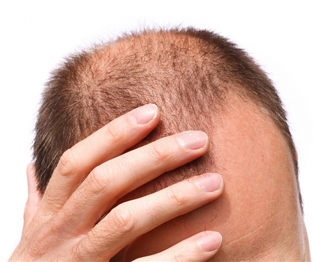 A Wearable Device for Regrowing Hair