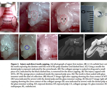 (PDF) Scientists Find Alzheimer's Drug Makes Teeth Grow Back - Tideglusib