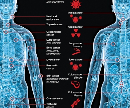 The Causes of Cancer