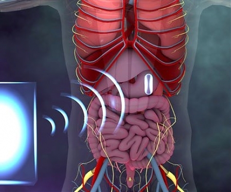(PDF) Gut Electronics Could be Wirelessly Powered