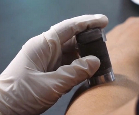 (Video) Simple But Ingenious Invention Takes the Ouch Out of Injections