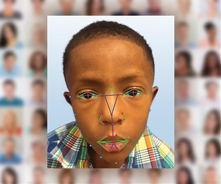 Facial Recognition Software Helps Diagnose Rare Genetic Disease