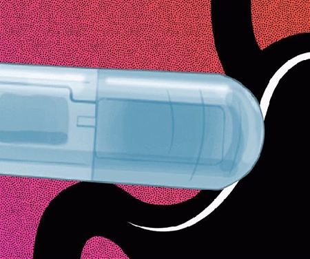 (Paper) MIT Engineers Develop a Vibrating, Ingestible Capsule That Might Help Treat Obesity