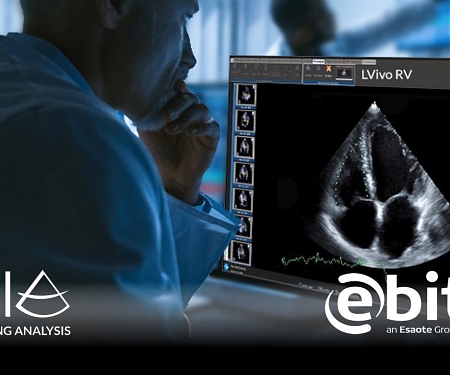 (Video) DiA Imaging Analysis Adds $14M for Its AI Ultrasound Solution