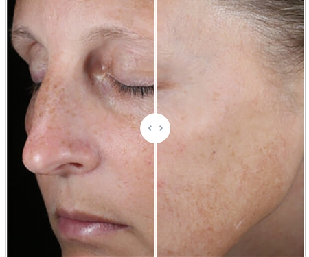 (M&A) L’Oréal Acquires Physician-Dispensed US Brand Skinbetter Science