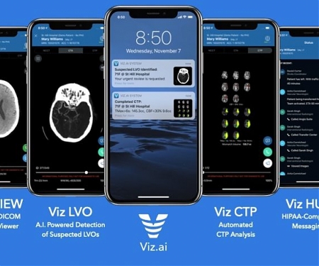 (Video) Viz.ai Raises $71M To Expand Its AI Software Beyond Stroke Diagnosis