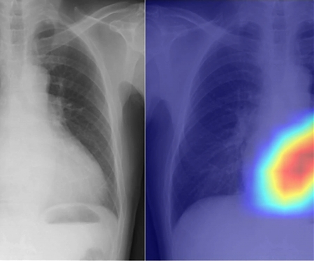 (Paper) AI Transforms The Humble Chest X-Ray Into a Better Diagnostic Tool