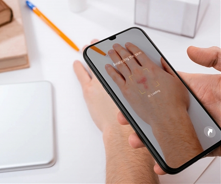 (Video) You Can Now Use Your Phone to ID Skin Conditions