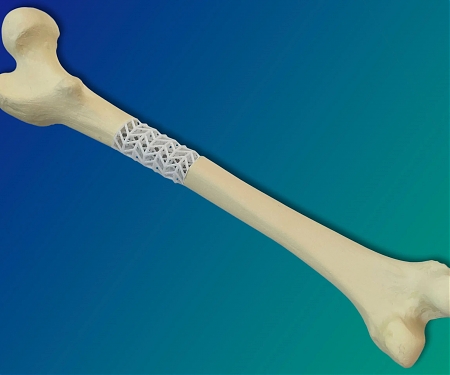 Fraunhofer - Bioactive Composite Supports Healing of Broken Bones