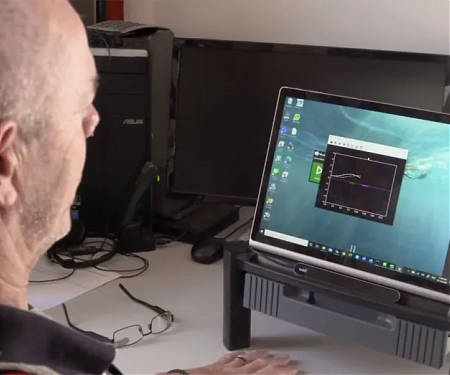 Brain Implant Startup, Syncron is Testing Mind-Controlled Computing on Humans