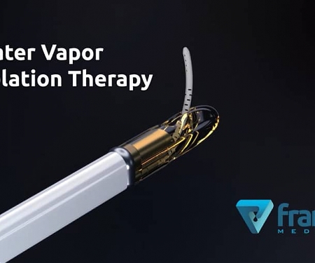 Francis Medical Announces Close of $55M Series B Equity Financing