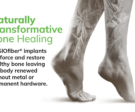 Ossio Raised $38.5M for Northopedic Fixation Technology